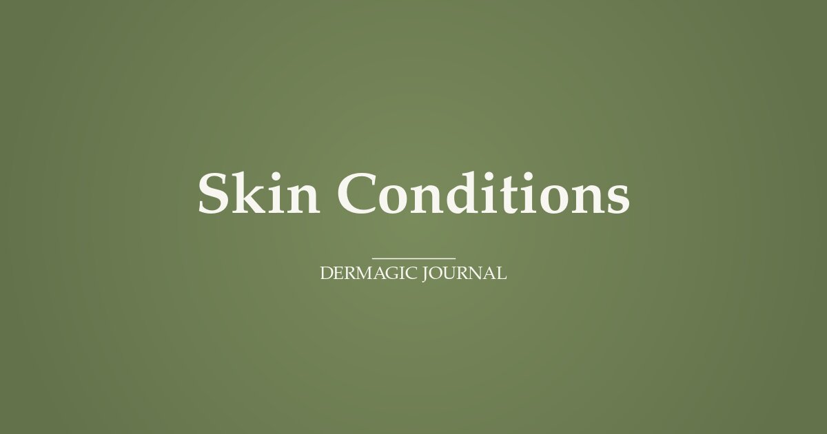 DERMagic Hot Spot Salve — How and When to Use It